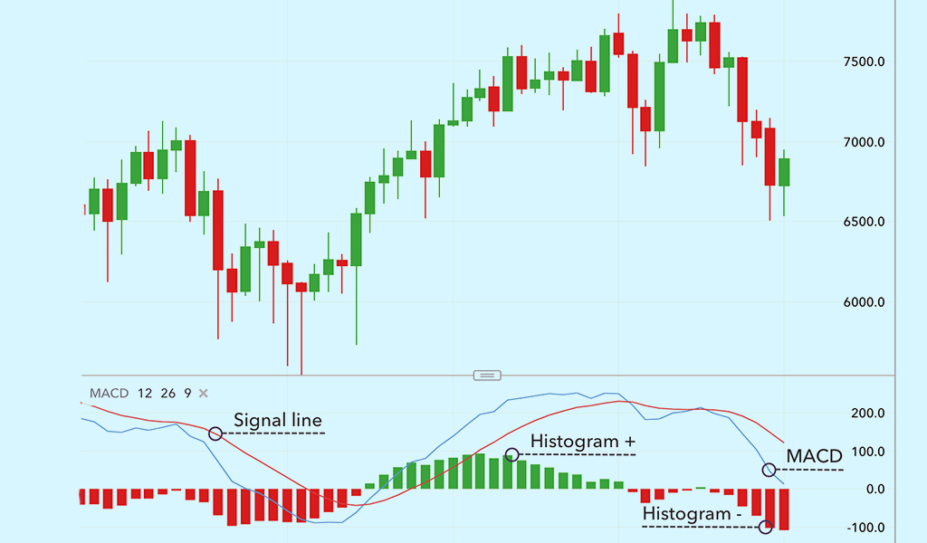 What-is-MACD